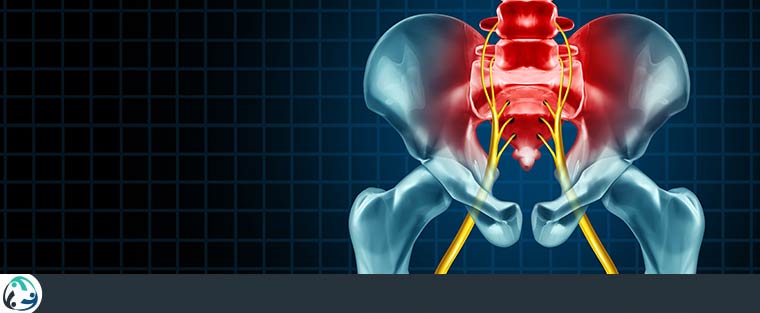 Sciatica Treatment Near Me in Allen, TX and Plano, TX Sciatica Treatment Near Me in Allen, TX and Plano, TX