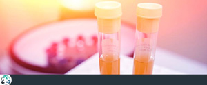 PRP (Platelet-Rich Plasma) Injections for Pain Near Me in Allen, TX & Plano, TX PRP (Platelet-Rich Plasma) Injections for Pain Near Me in Allen, TX & Plano, TX