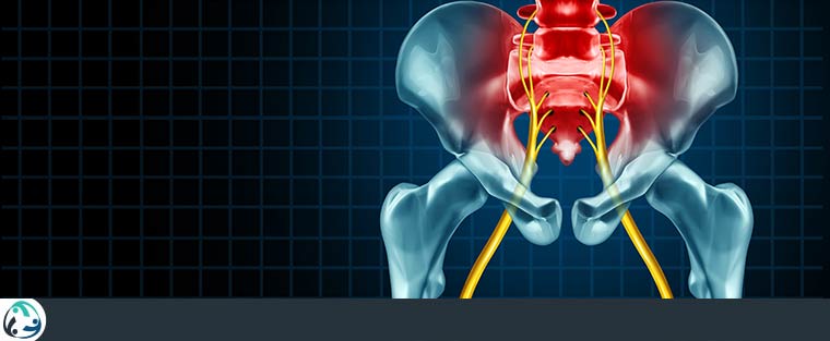 Radiculopathy vs Sciatica Pain Near Me in Allen, and Plano, TX