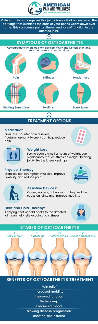 Start your journey towards better health today! Visit American Pain and Wellness for the treatment of osteoarthritis. Our specialists will help manage your symptoms. We have convenient locations in Texas. For more information, please contact us or request an appointment online. Start your journey towards better health today! Visit American Pain and Wellness for the treatment of osteoarthritis. Our specialists will help manage your symptoms. We have convenient locations in Texas. For more information, please contact us or request an appointment online.