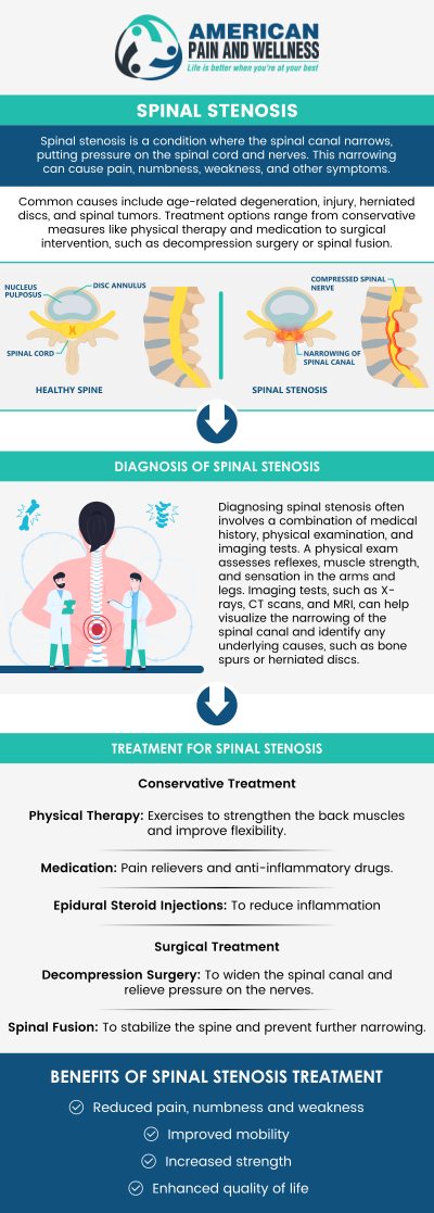 If you are suffering from spinal stenosis pain, then visit American Pain and Wellness for lasting back pain relief. We have convenient locations in Texas. For more information, please call us. If you are suffering from spinal stenosis pain, then visit American Pain and Wellness for lasting back pain relief. We have convenient locations in Texas. For more information, please call us.